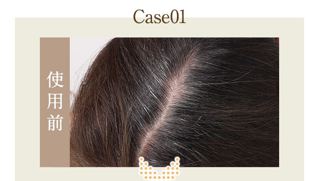 Case01　使用前