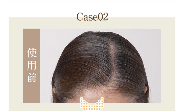 Case02　使用前